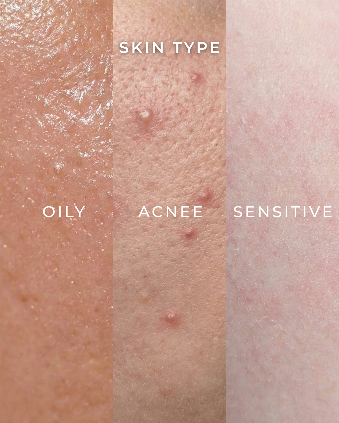 The Ampoule | Tea Trica