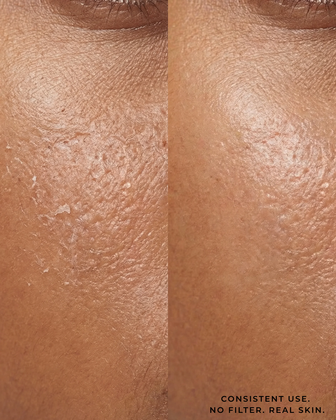 The Ampoule | Hyalu-Cica