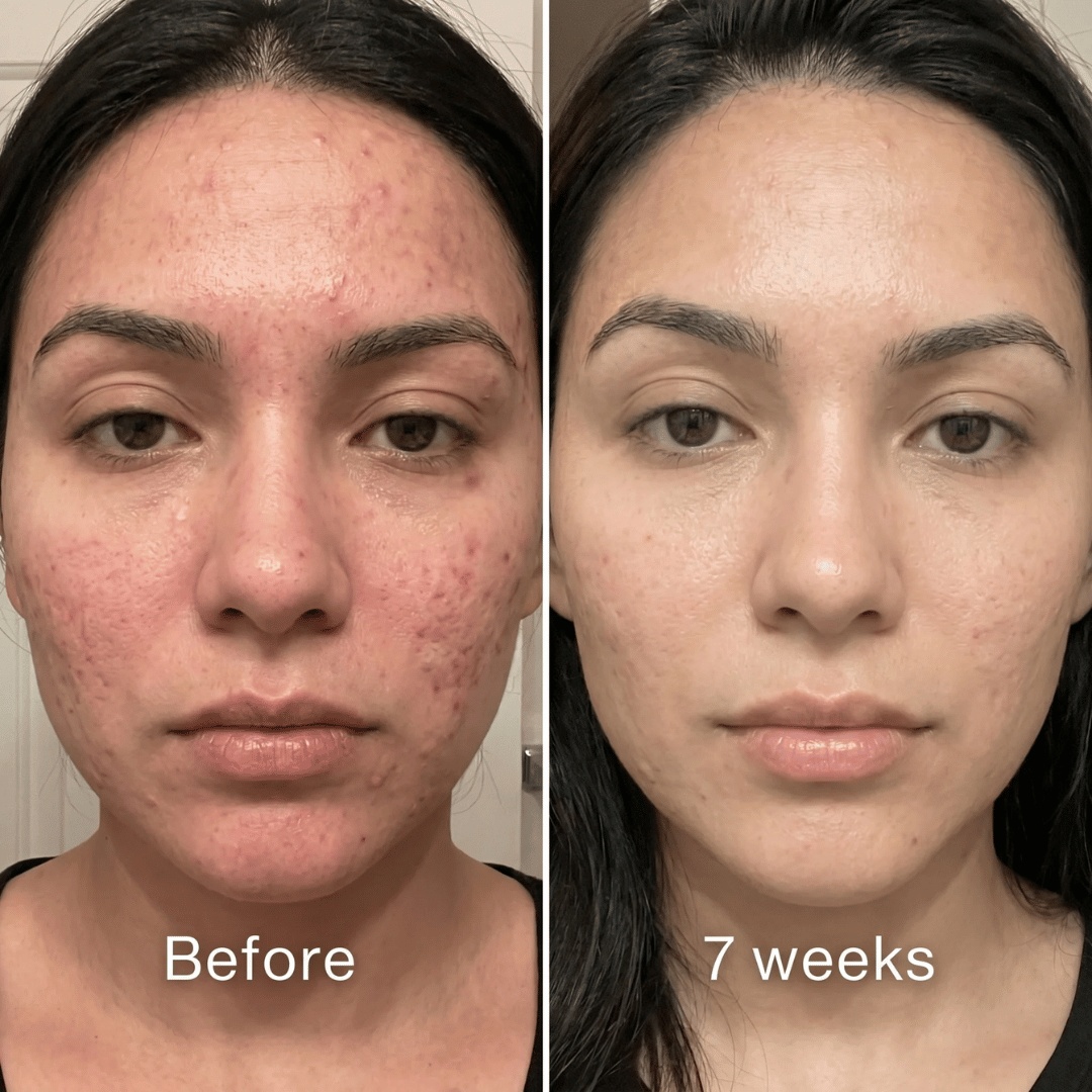 Clinical Acne Scar Repair Stick™