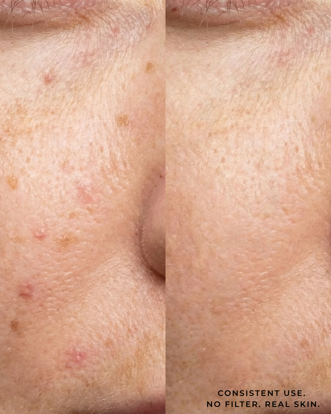 The Ampoule | Tone Brightening