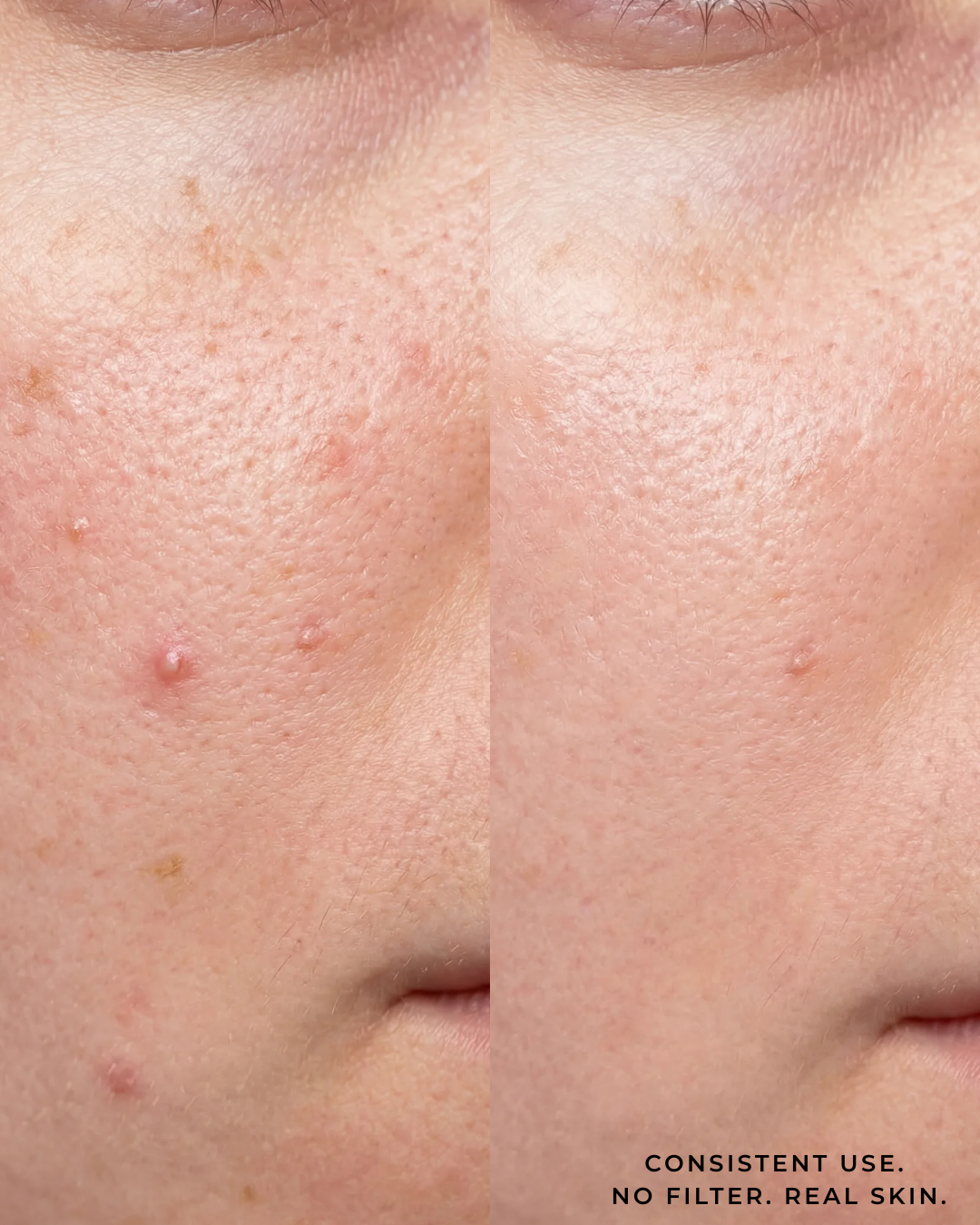 The Ampoule | Tea Trica