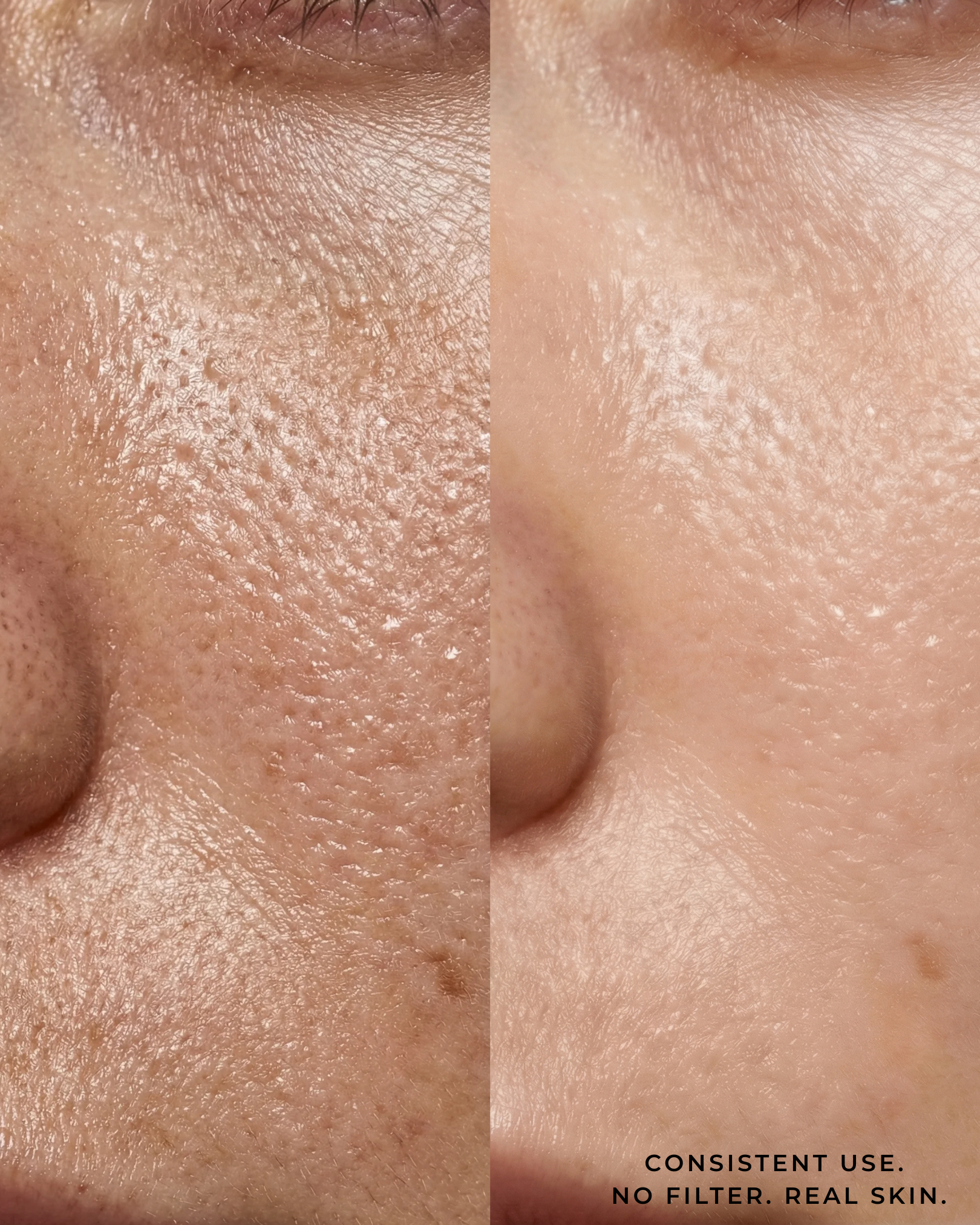 The Ampoule | Poremizin